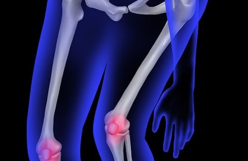 human bone, anatomy, knee pain, patella, leg pain, orthopedics